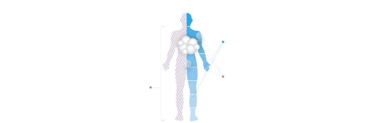 Hodgkin lymphoma infographic